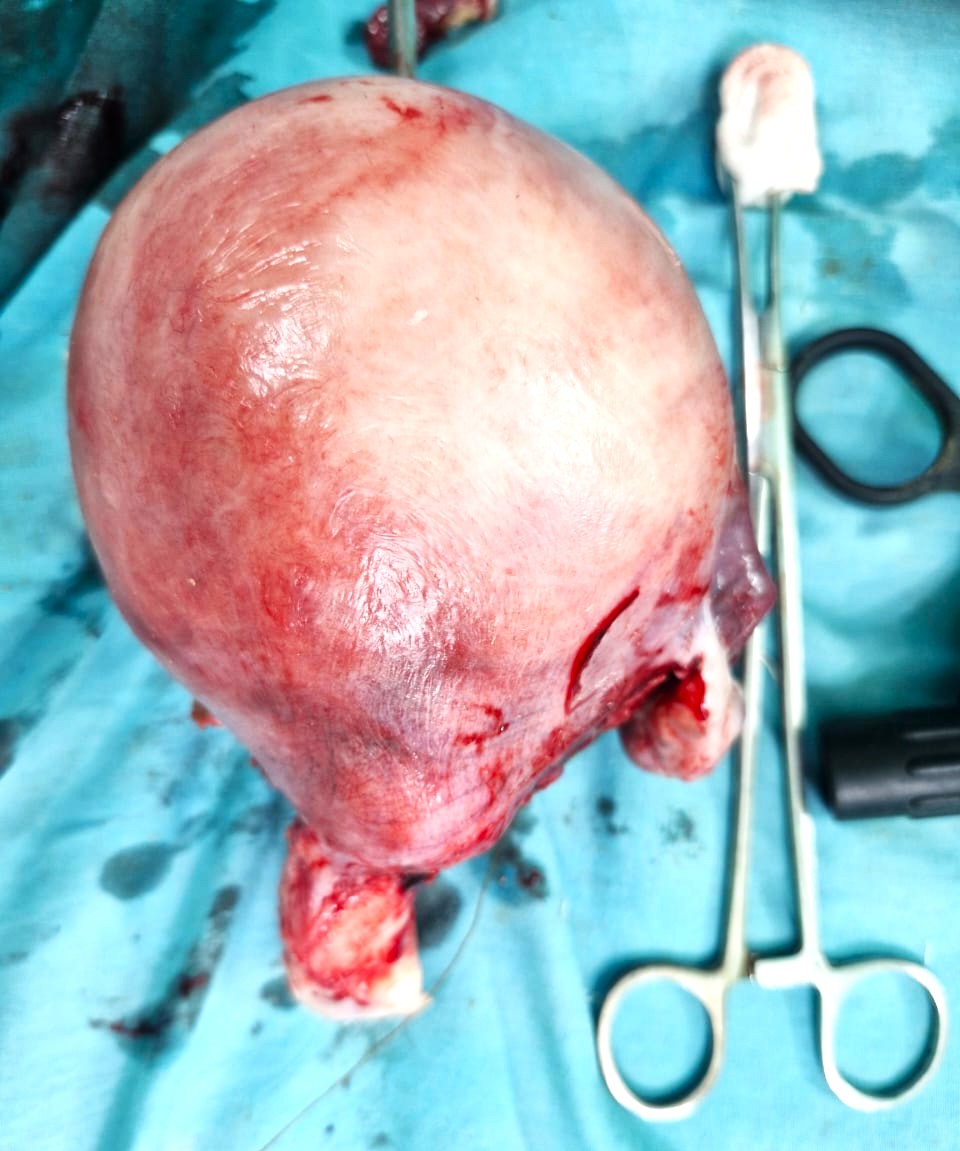 Clinical surgical specimen from a gynaecological procedure